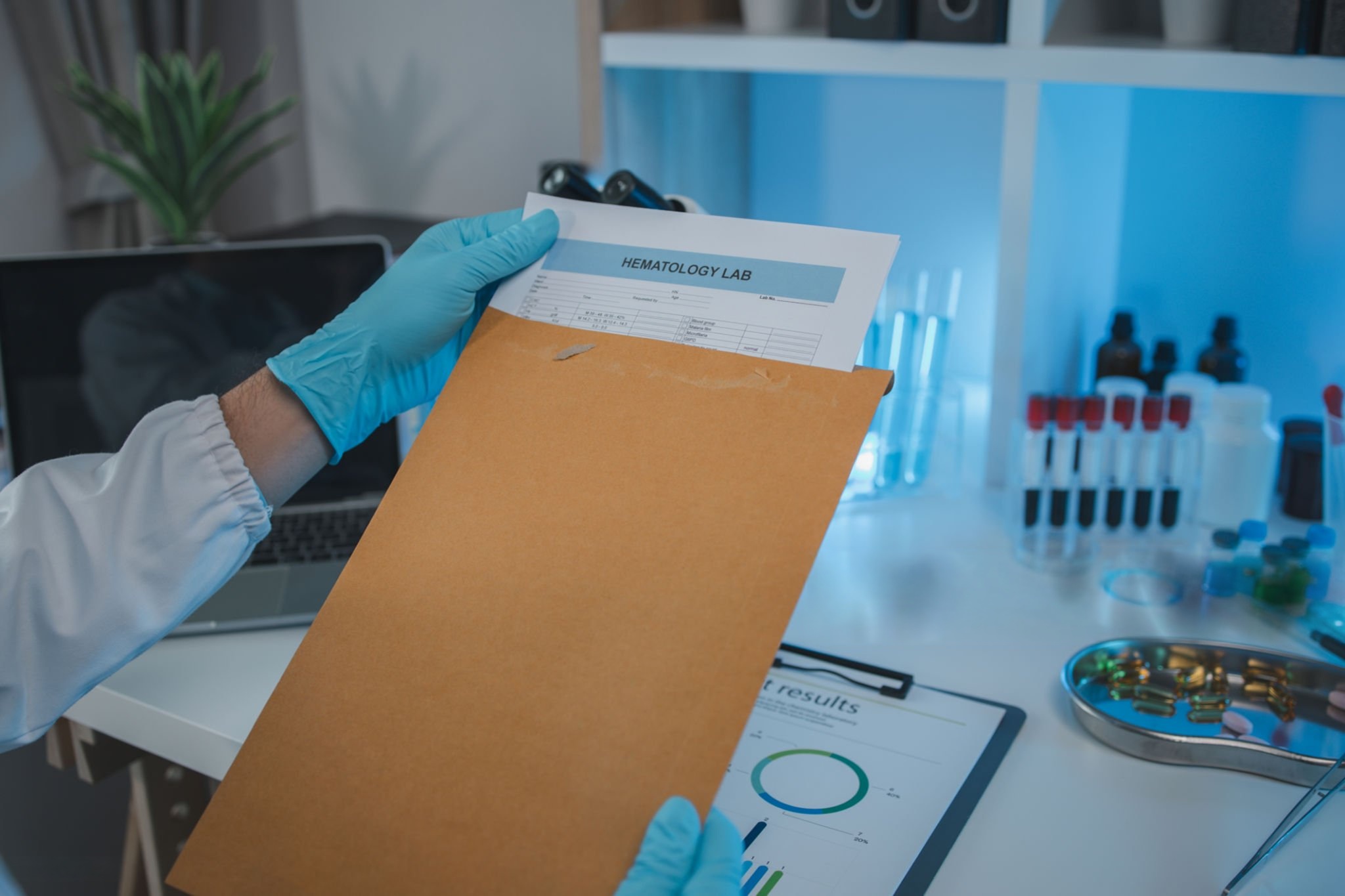 Automated Report Delivery